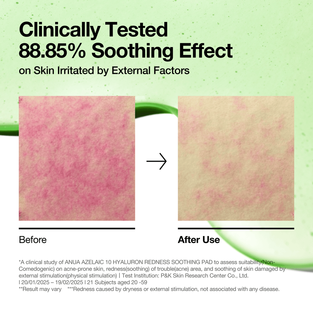 [Anua] Azelaic 10 Hyaluron Redness Soothing Pad 230ml 90ea image 7