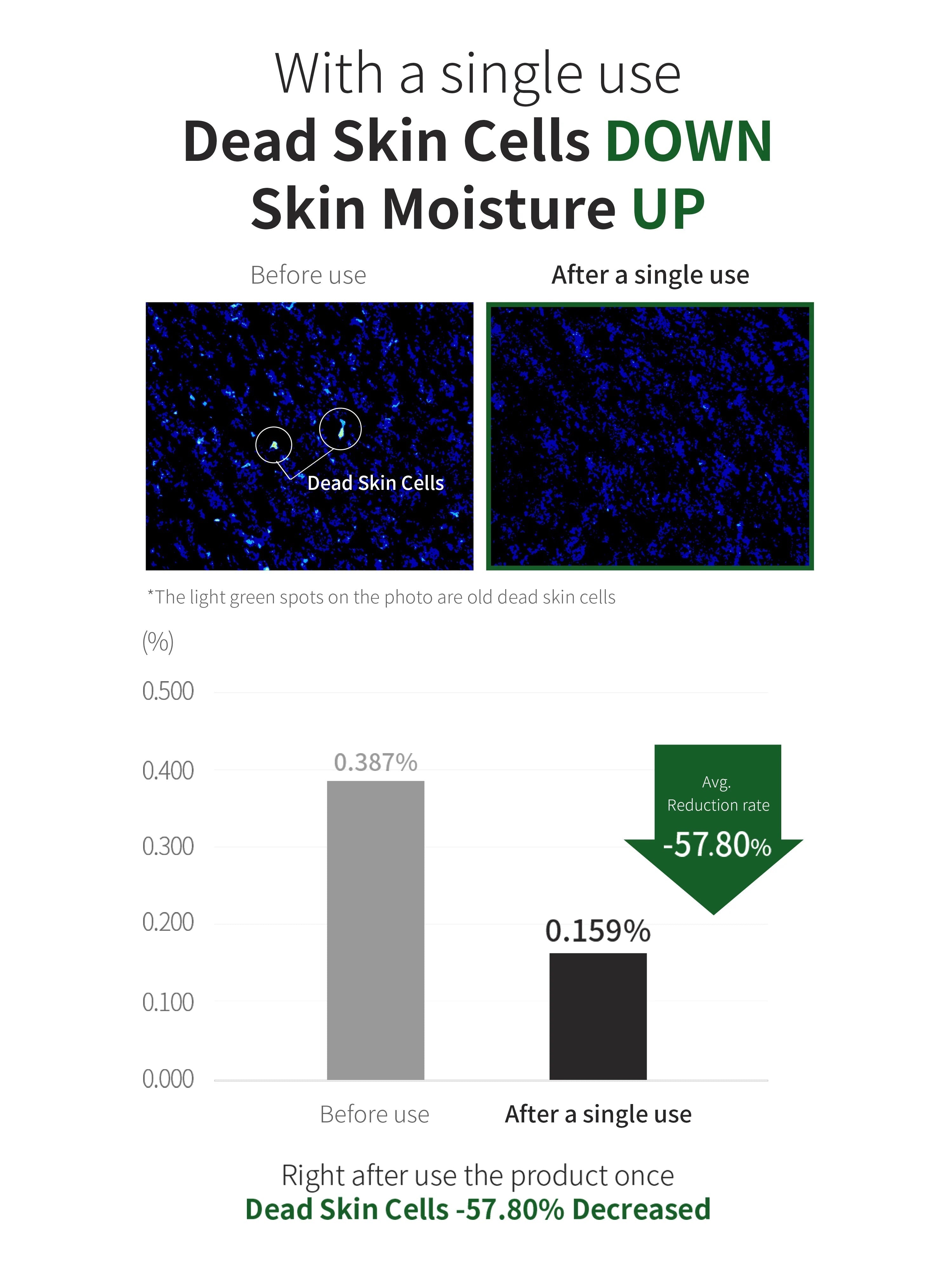 [Benton] Aloe BHA Skin Toner 200ml - Renewal image 11