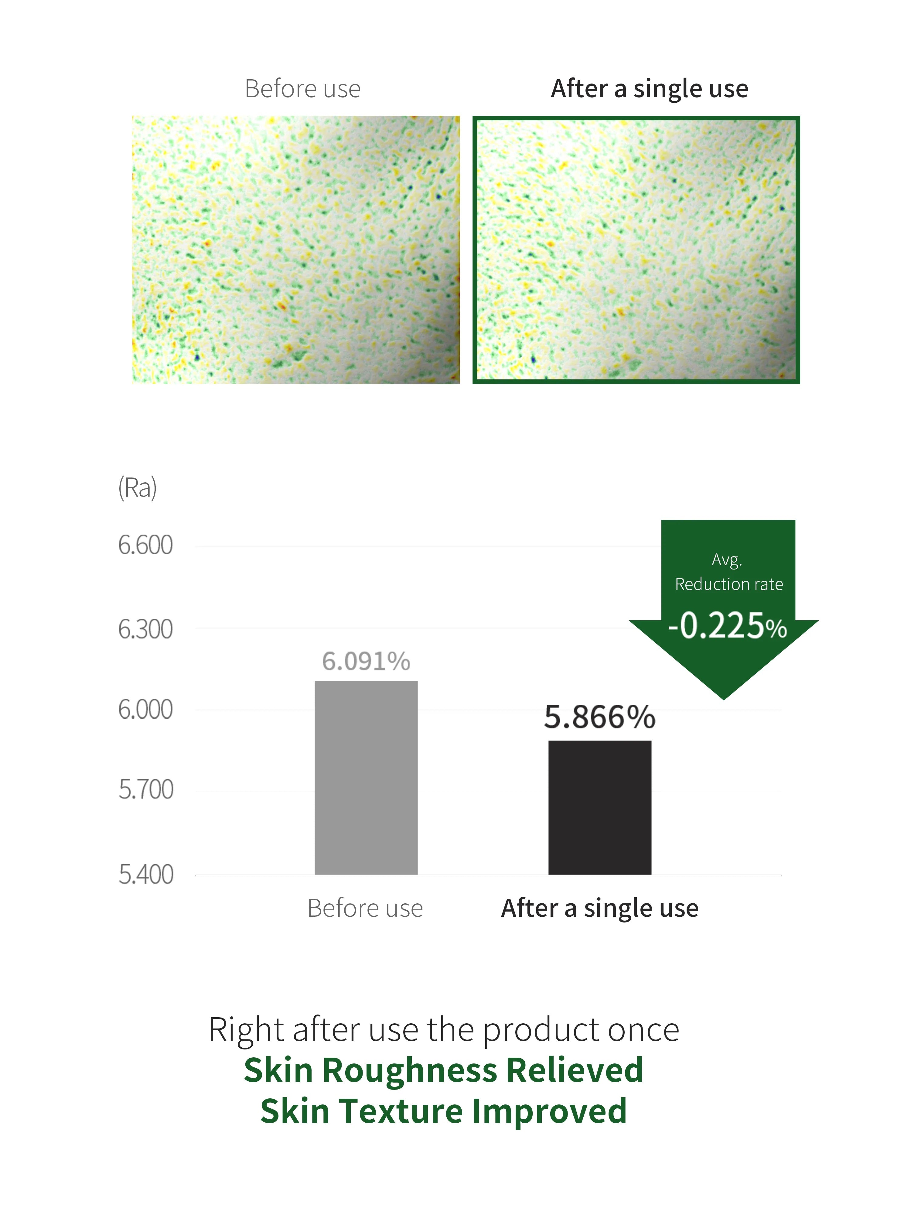 [Benton] Aloe BHA Skin Toner 200ml - Renewal image 12