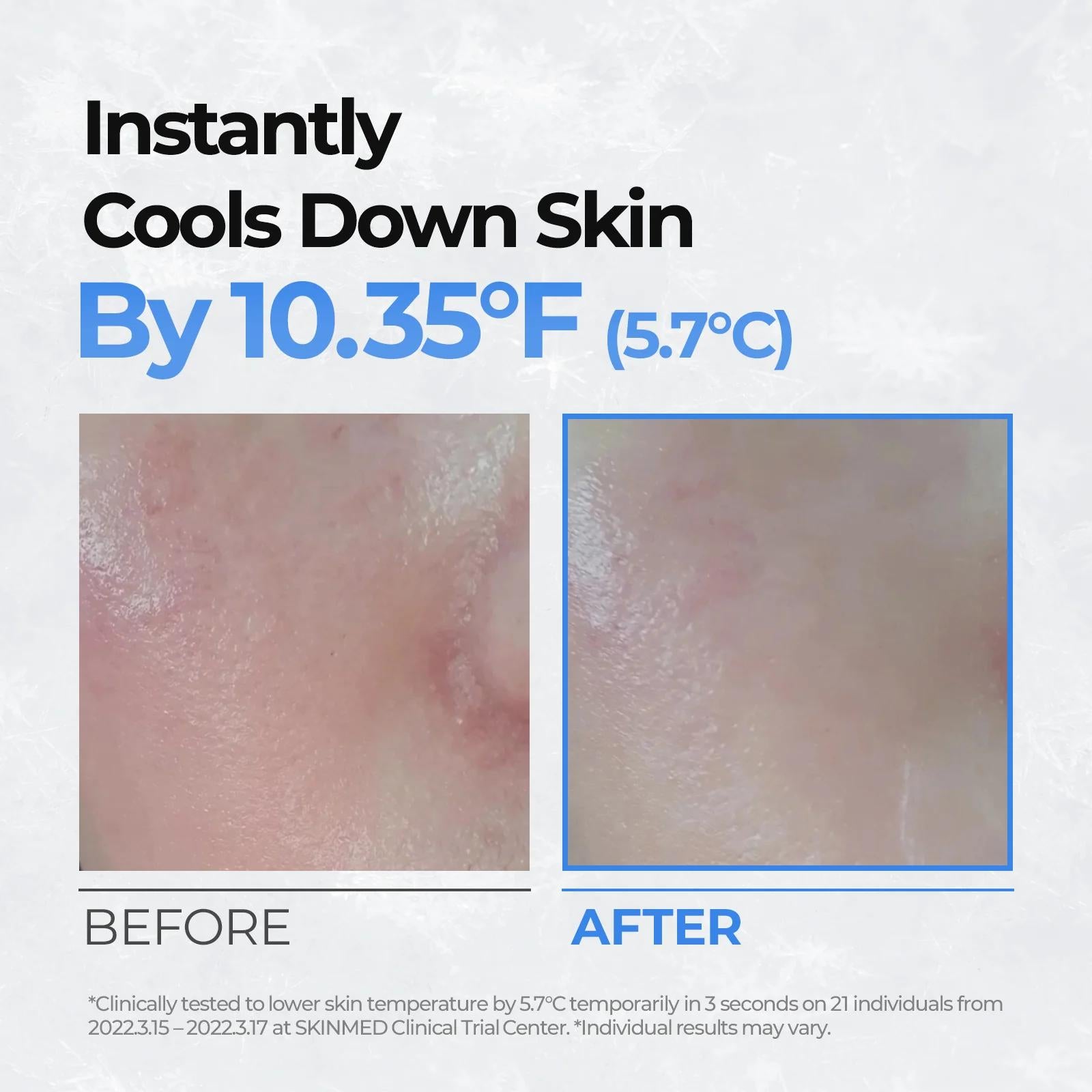 [CellFusionC] Post Alpha Cooling Pad - 70 Pads_MX image 5