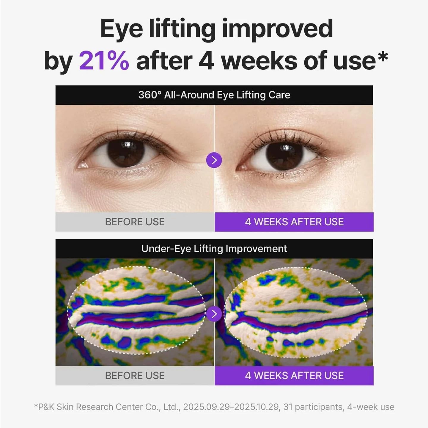 [Centellian24] 360º Shot PDRN lifting Eye cream 30ml*2ea_MX image 4