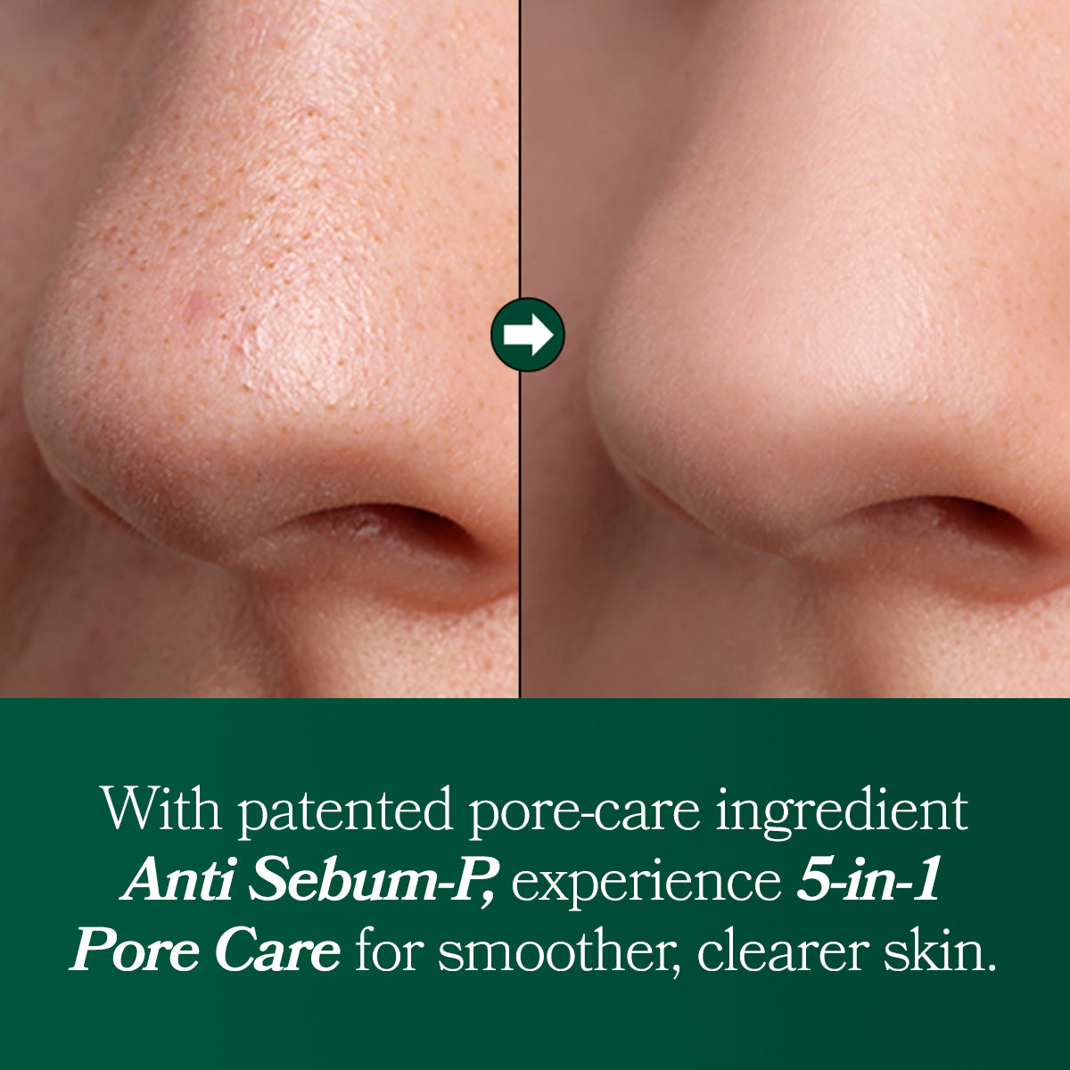 [Omitted] Fresh Lime Glow & Pore Refining Serum 50ml image 10