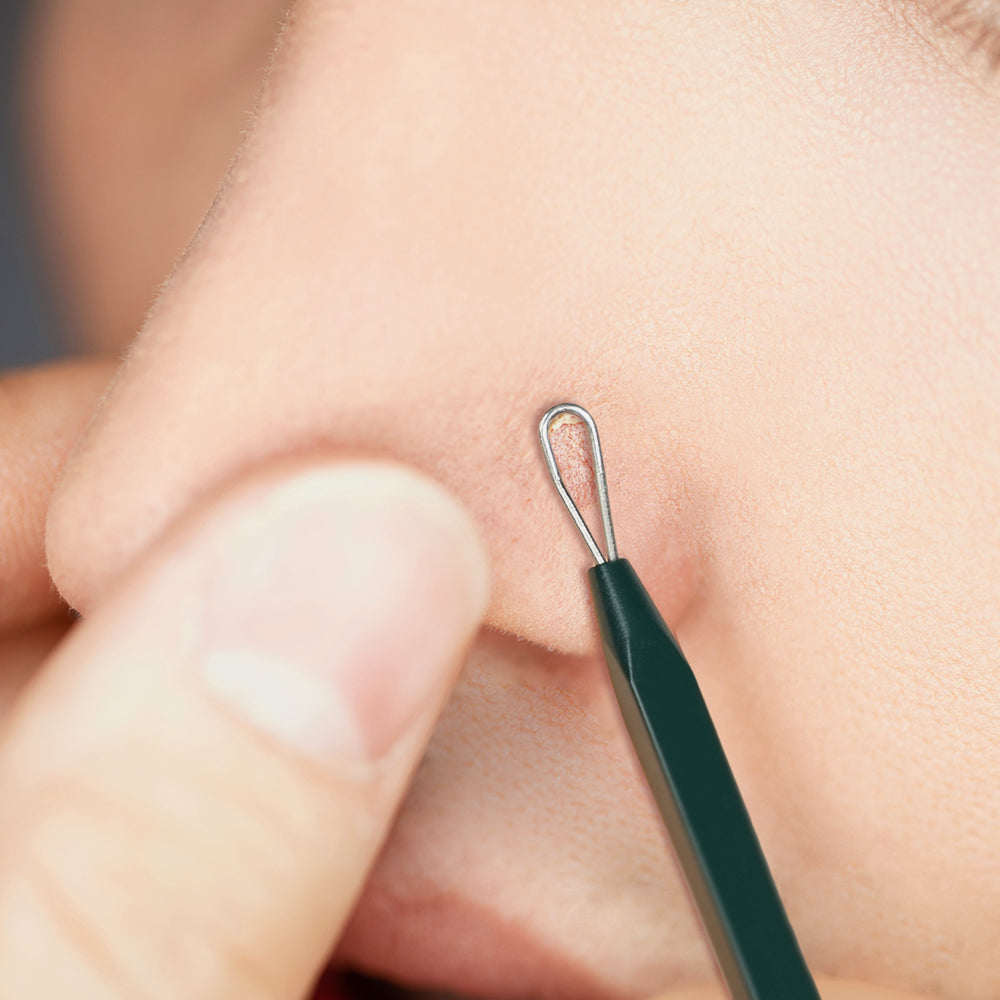 [PyunkangYul] Pimple Extractor image 3
