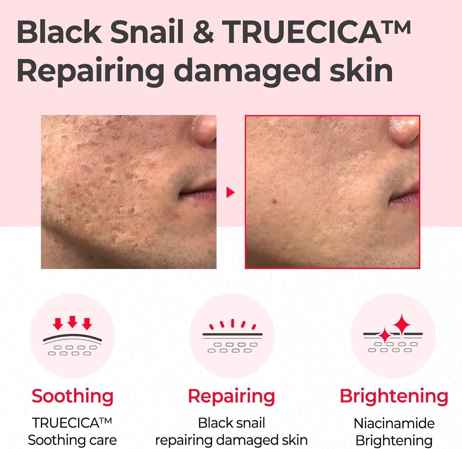 [SomeByMi] Snail Truecica Miracle Repair Toner 150ml image 6